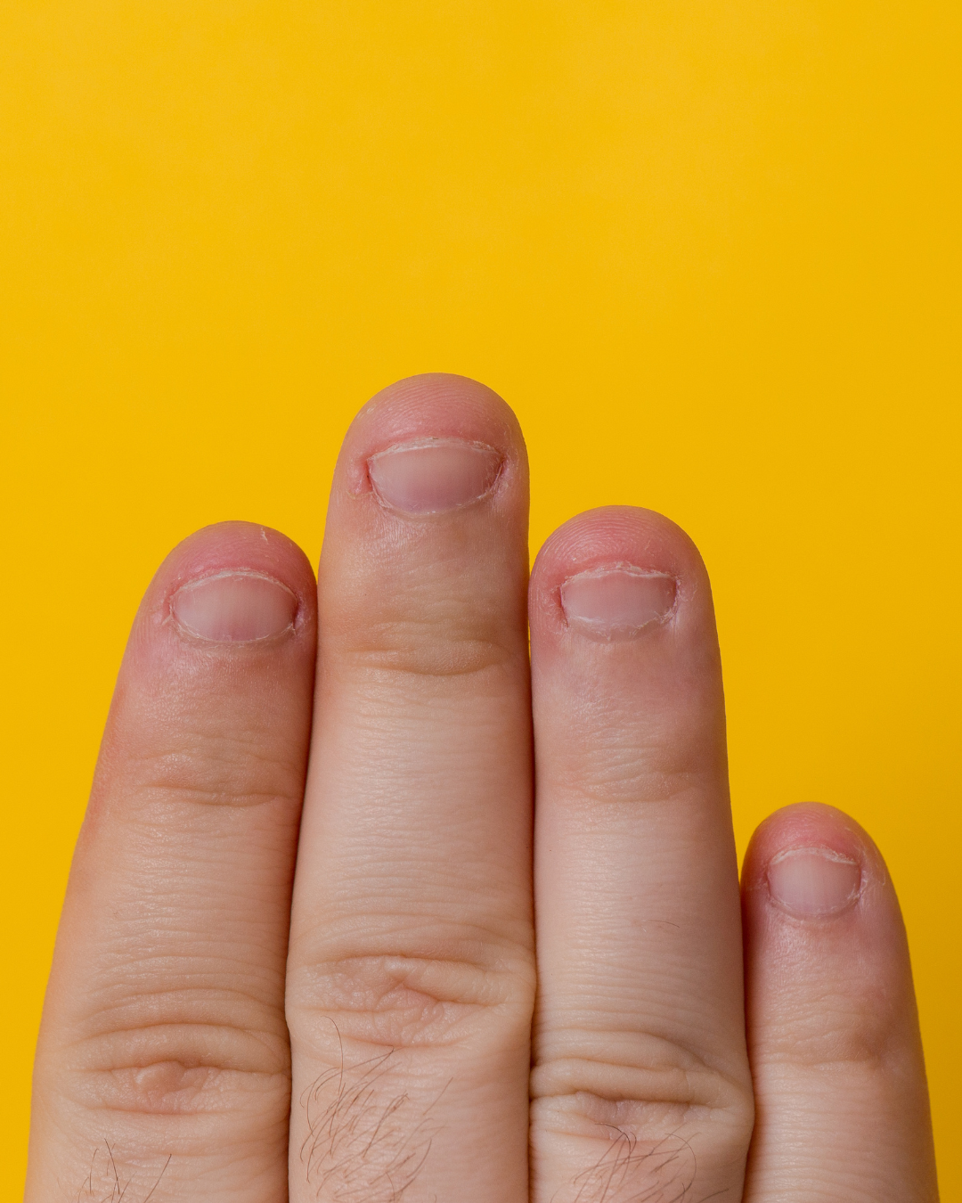 Nails Strong Growth & Repair Oil – 30ml