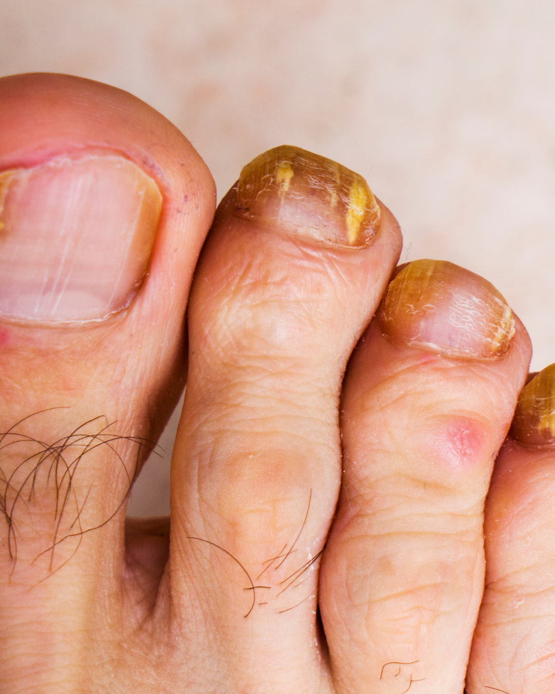 Nails Strong Growth & Repair Oil – 30ml