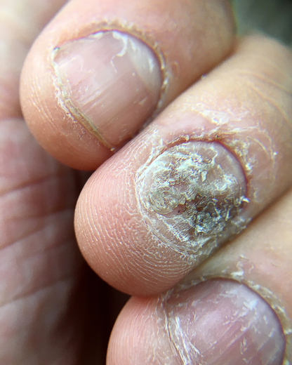 Nails Strong Growth & Repair Oil – 30ml