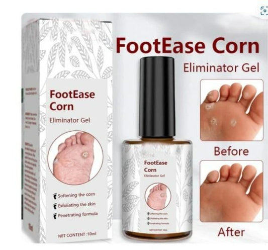 Feet Corn Removal Serum 30ml – Liquid Foot Care for Hard Skin, Cracked Heels & Corn Support (Pack of 1)