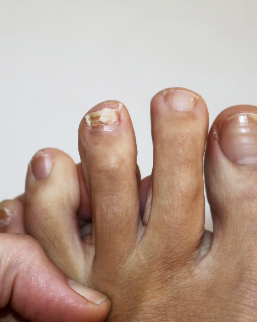 Nails Strong Growth & Repair Oil – 30ml