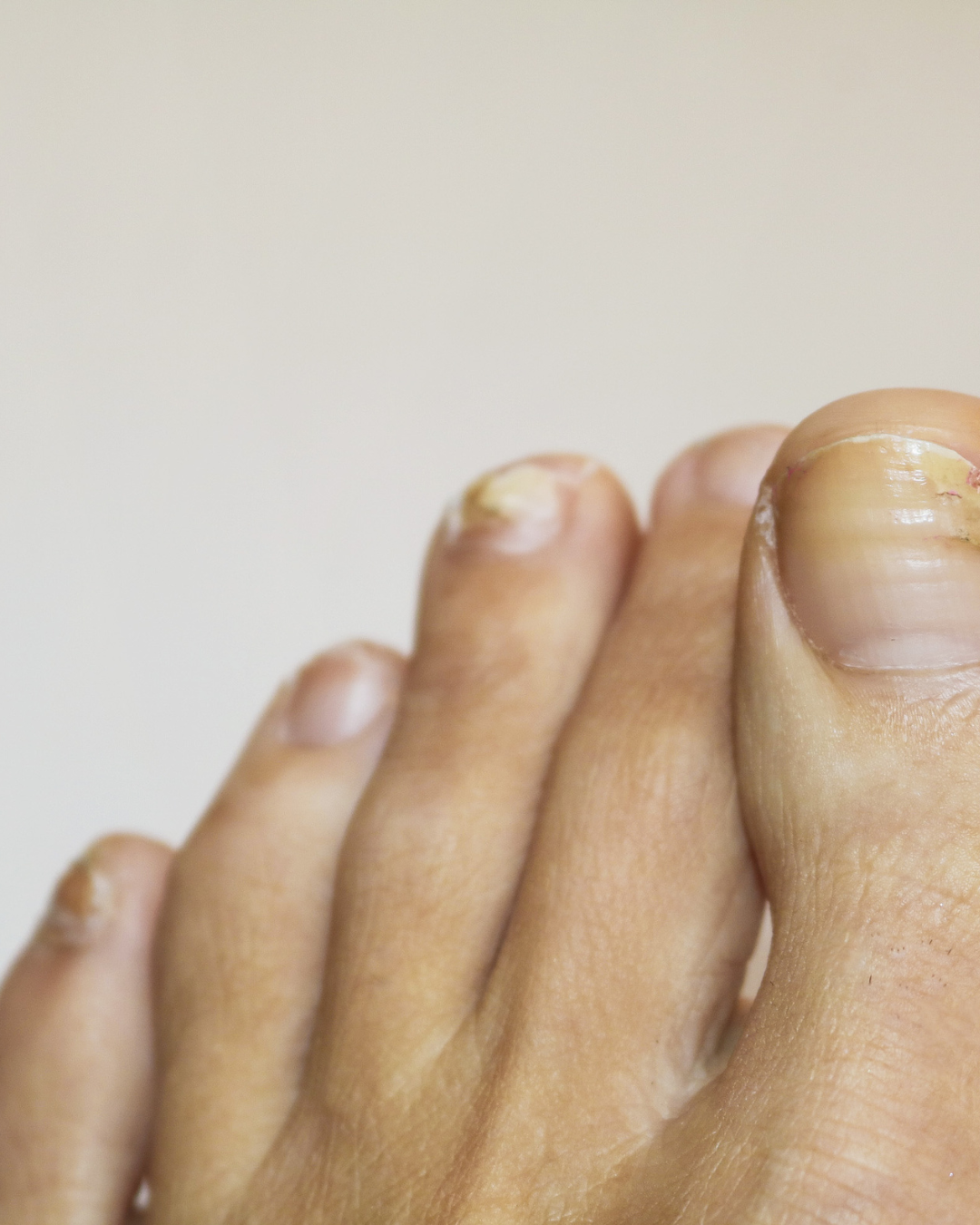 Nails Strong Growth & Repair Oil – 30ml