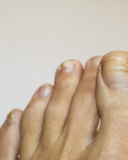 Nails Strong Growth & Repair Oil – 30ml