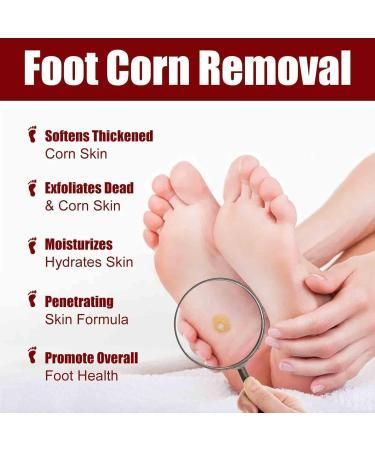 Feet Corn Removal Serum 30ml – Liquid Foot Care for Hard Skin, Cracked Heels & Corn Support (Pack of 1)