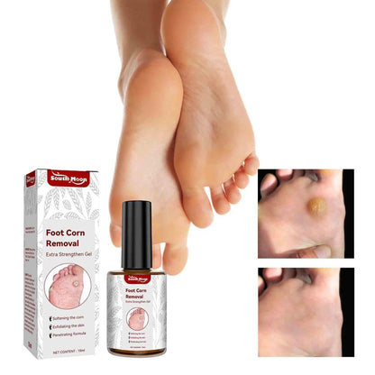 Feet Corn Removal Serum 30ml – Liquid Foot Care for Hard Skin, Cracked Heels & Corn Support (Pack of 1)