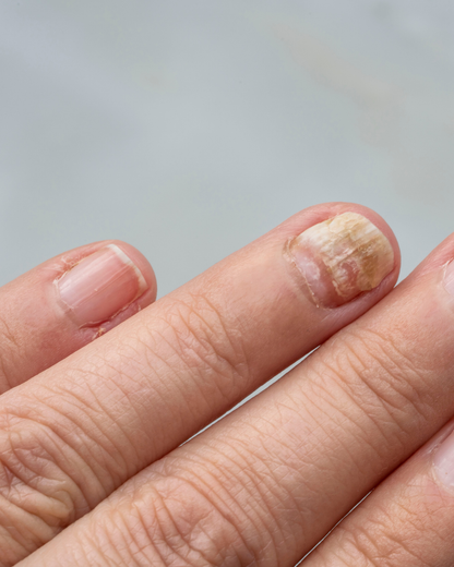 Nails Strong Growth & Repair Oil – 30ml