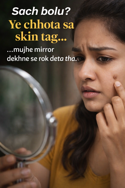 Tags & Moles Remover Cream (Pack of 2) – Skin Care Formula