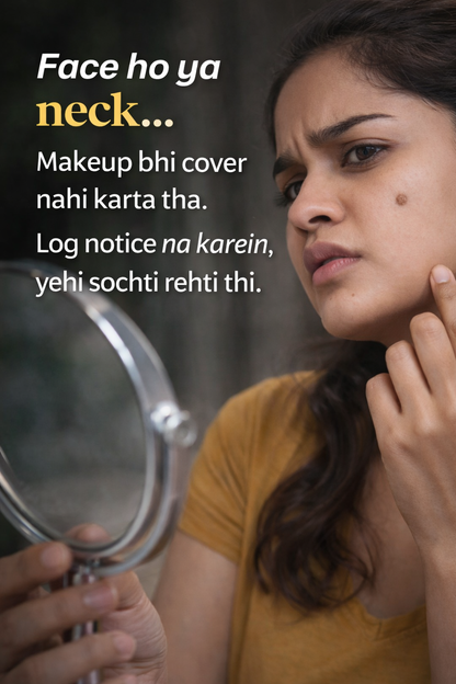 Tags & Moles Remover Cream (Pack of 2) – Skin Care Formula