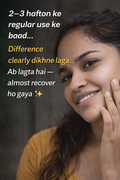 Tags & Moles Remover Cream (Pack of 2) – Skin Care Formula