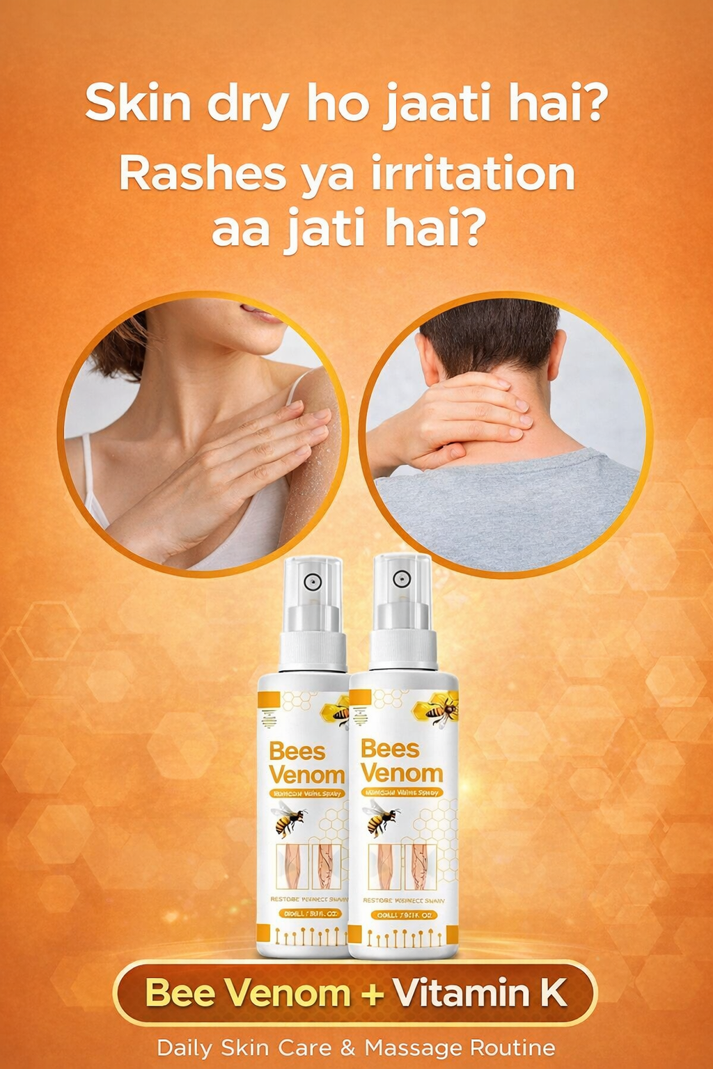 Bee Venom Spider Veins Spray (Pack of 2) – Bee Venom & Vitamin K Based Skin Comfort Formula