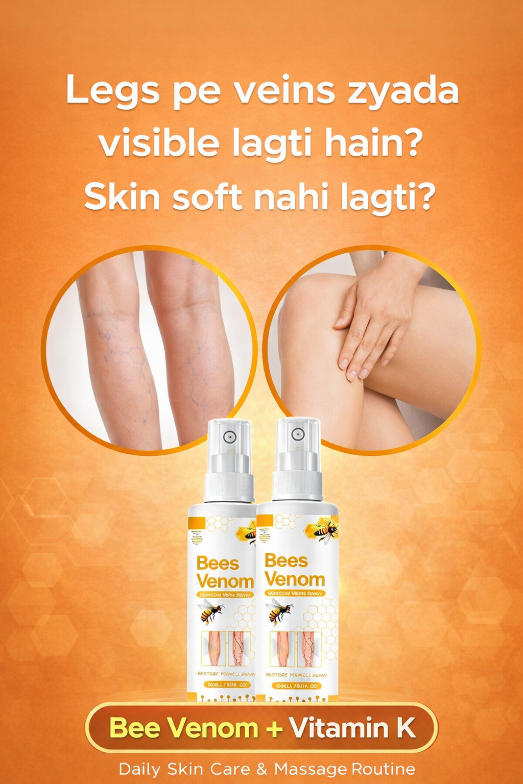 Bee Venom Spider Veins Spray (Pack of 2) – Bee Venom & Vitamin K Based Skin Comfort Formula