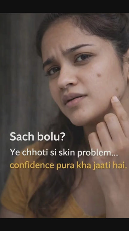 Tags & Moles Remover Cream (Pack of 2) – Skin Care Formula